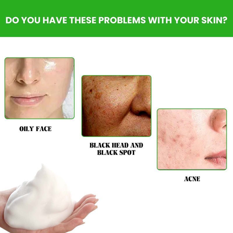 Anti Acne Facial Wash, Deep Clean Oil Dirt Blackhead Acne Shrink Pores Refreshing And Comfortable