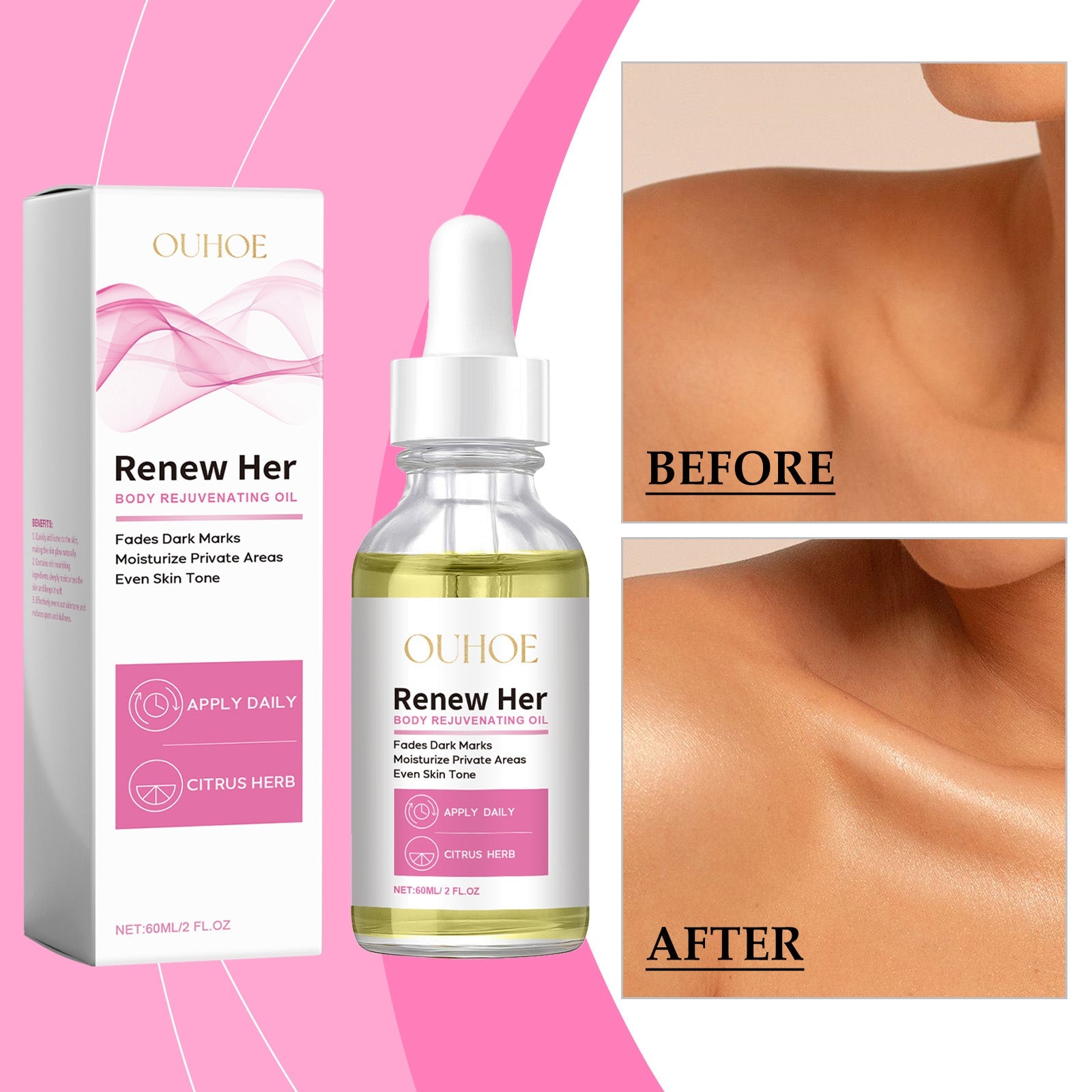 OUHOE Body Brightening Oil Moisturizes And Restores Dark, Brightening, Delicate And Easy To Absorb