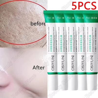 5Pcs