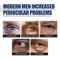 Rejuvenate Eyes Peptide Lifting Eye Gel, Hydrating Moisture Lock Moisture Repair Dull Anti-Aging Eye Care Cream
