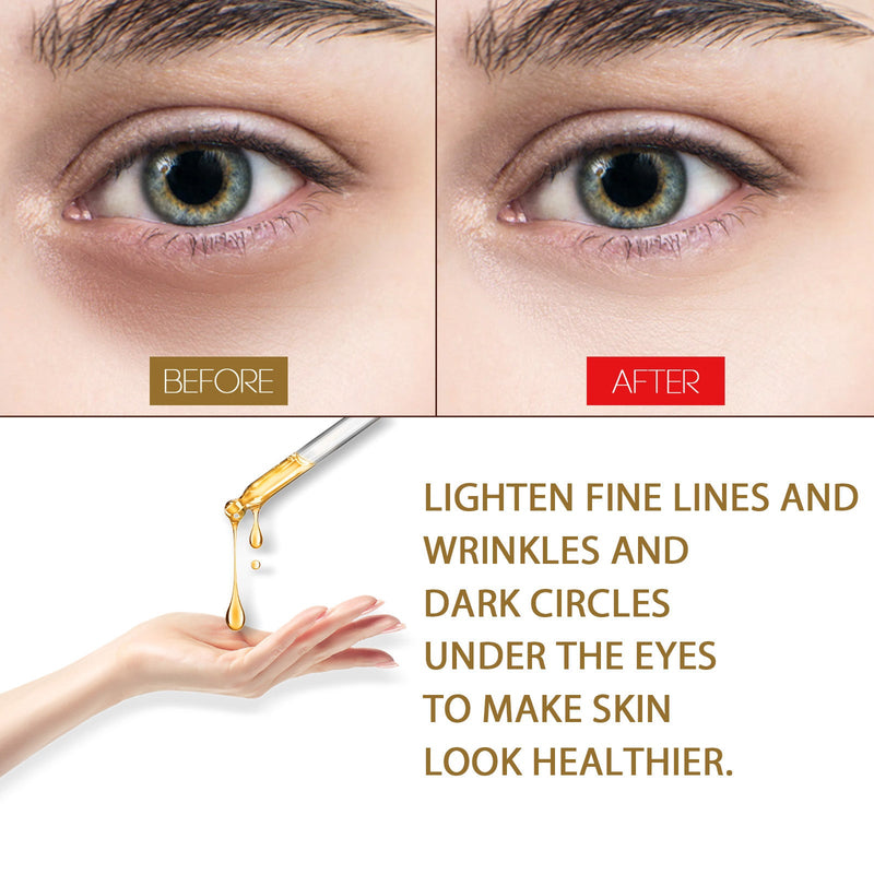 Anti-Aging Eye Serum, Eye Bags, Pores, Eyes, Fine Lines And Dark Circles Care Essence