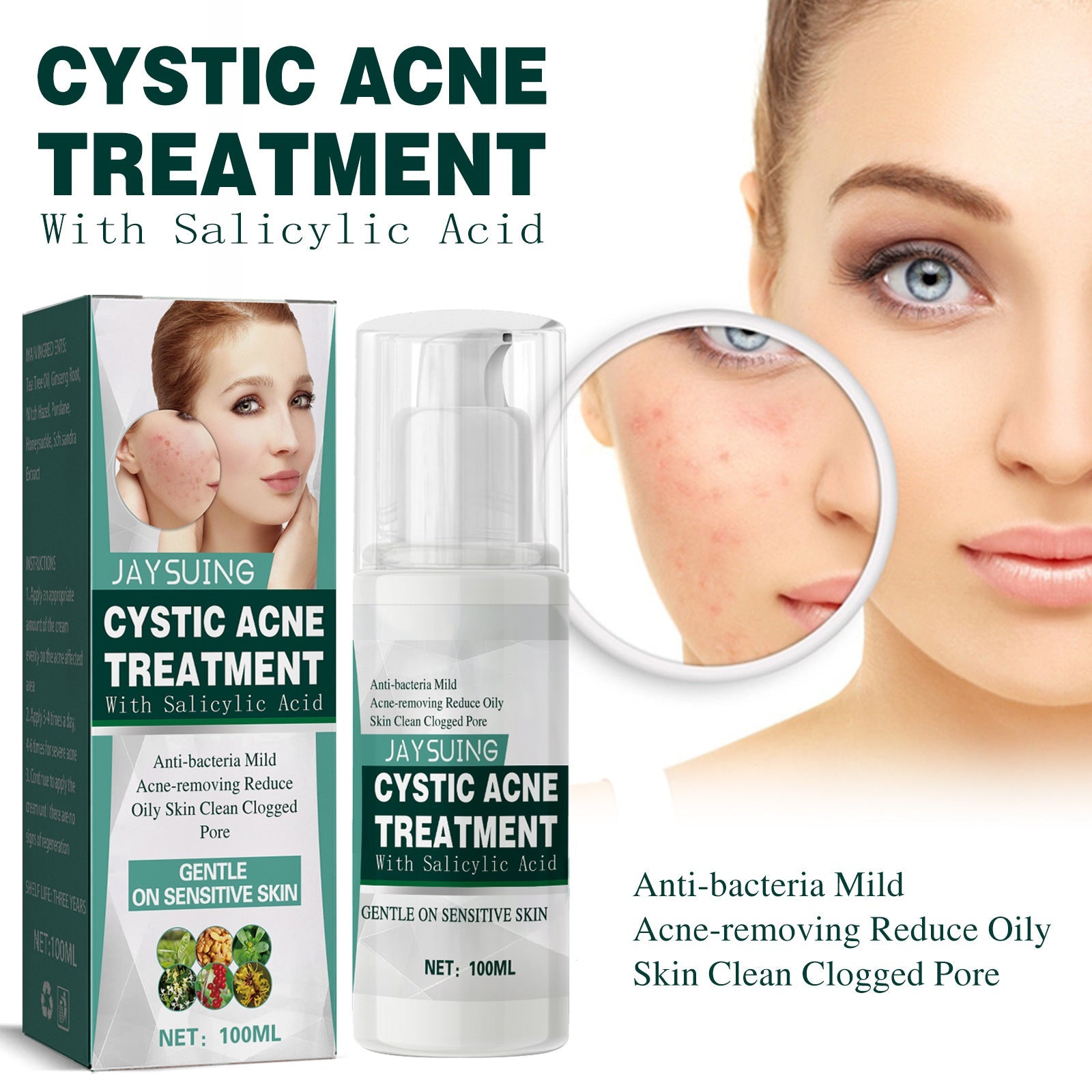 Cystic Acne Treatment, Acne Removing Face Repair Cream For Closed Pimples And Acne Marks