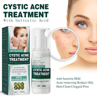 Cystic Acne Treatment, Acne Removing Face Repair Cream For Closed Pimples And Acne Marks
