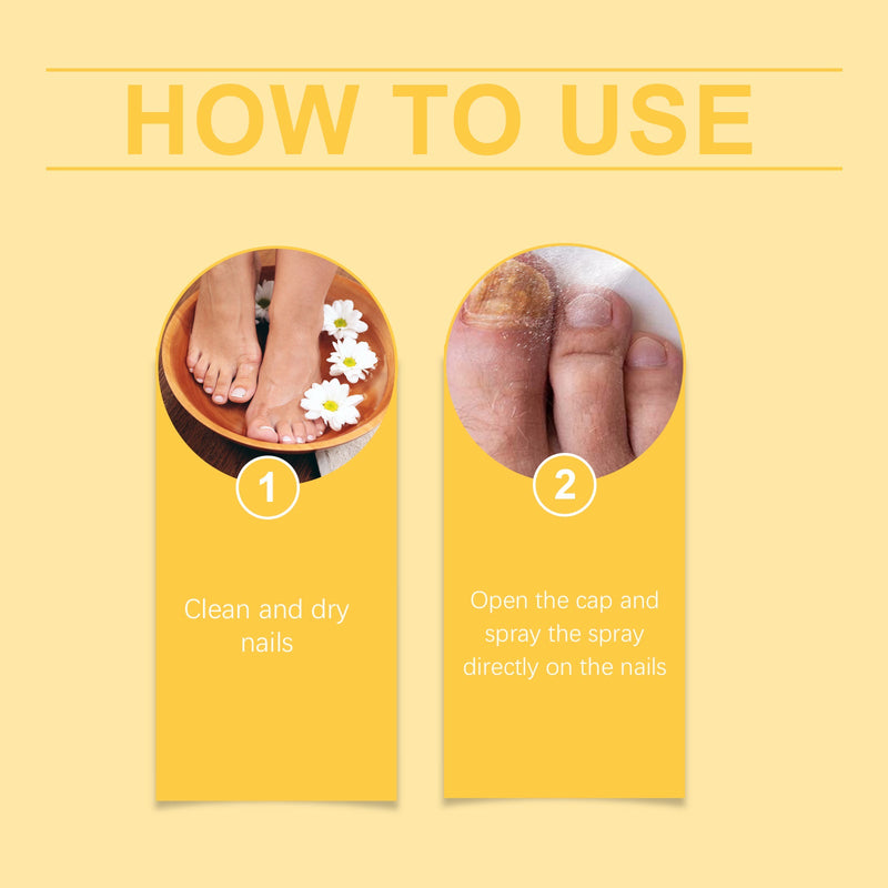 Bee Venom Nail Spray Pedicure Cleaning And Repairing Smooth And Clean Nourishing Care Solution