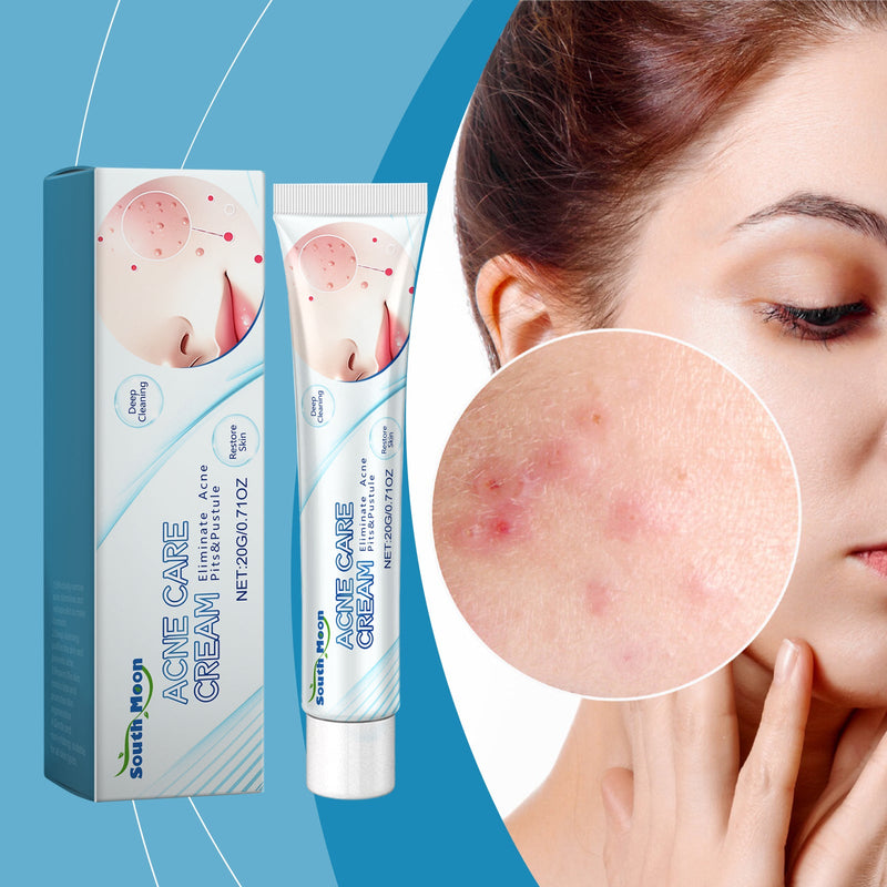 Acne Repair Cream Acne Mark Treatment Improve Acne Muscle Cleansing Cream For Closed Mouth Acne