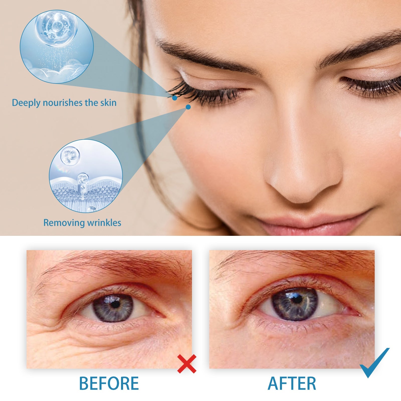Retinol Eye Cream For Wrinkles Reduces Fine Lines, Dark Circles And Bags Under Eyes