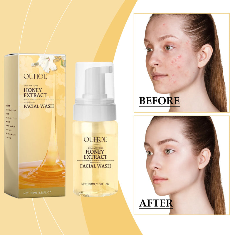Gentle Honey Foam Cleanser, Gently Cleanses Skin, Hydrates And Refreshes Oil Control Foam Cleanser