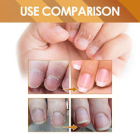 Instant Cuticle Treatment Gel Repair Gray Nails Soft Nails Rotten Nails Dead Skin Moisturizing Treatment