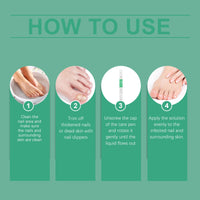 Nail Repair Pen Moisturizes Gently Repair Hands And Feet Gray Nails Soft Nails Thick Nails Foot Care