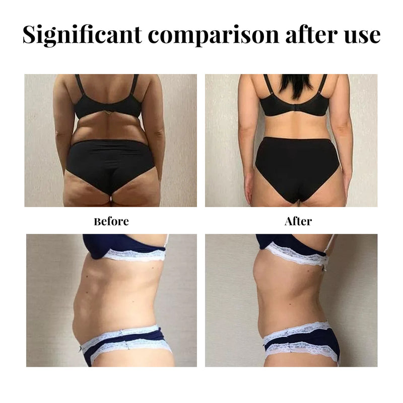 EELHOE Belly Lift Tape, Lifts Loose Skin Tighten Shape Slim Belly Button Tape