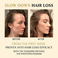 West&Month Hair Boost Darken Strengthen Essence, Scalp Massage Moisturizing Hair Roots Thick Smooth Hair Care Ball