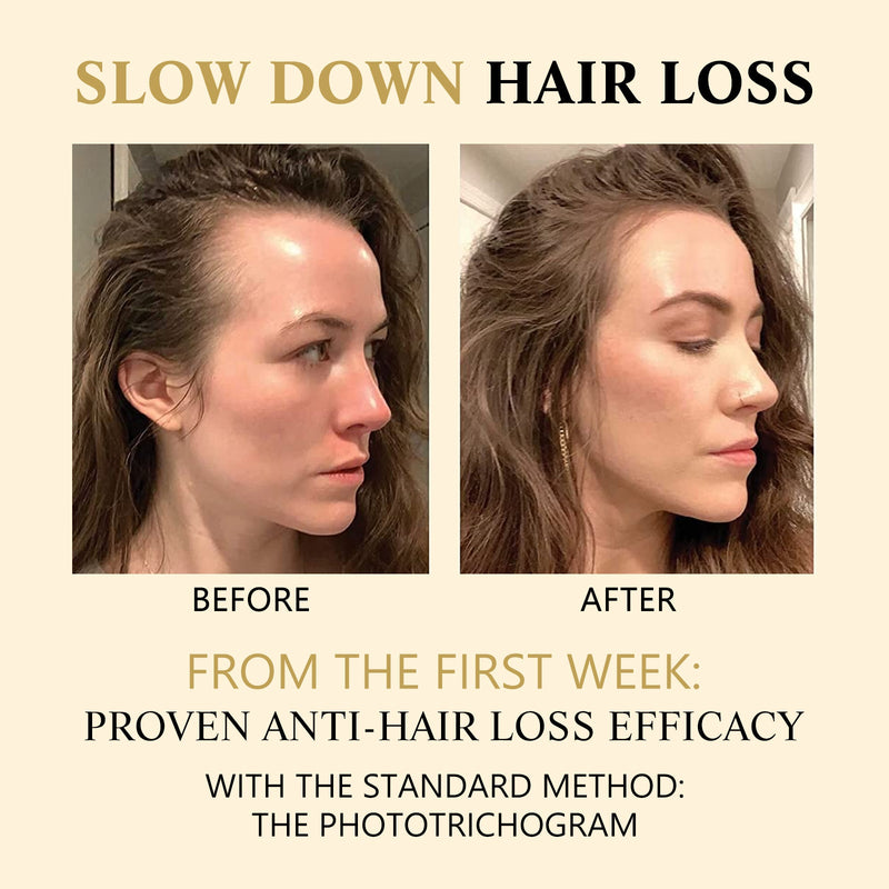West&Month Hair Boost Darken Strengthen Essence, Scalp Massage Moisturizing Hair Roots Thick Smooth Hair Care Ball