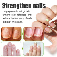 Oceaura Nail Care Essence, Moisturizing, Brightening And Strengthening Essence For Repairing Broken Nails