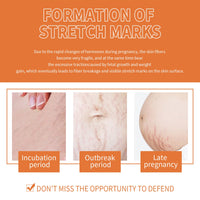 OUHOE Pregnancy Massage Oil, Repair Pregnant Women Prenatal And Postpartum Stretch Mark Skin Care Massage Oil