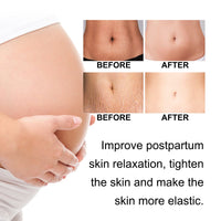 Ouhoe Pregnancy Care Cream Moisturizes And Restores Fine Lines Of Postpartum Skin To Firm, Soft And Smooth Body Skin