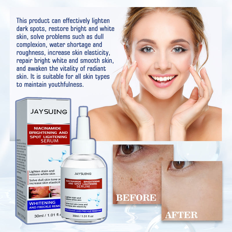 Nicotinamide Brightening And Spot Reducing Serum, Moisturizes Brightens Whiten Skin And Removes Dark Spots Serum