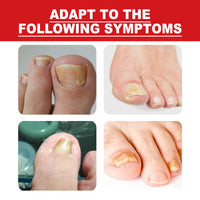 Toenail Repair Essence Moisturizes, Restores And Cleanses Foot Nails And Brightens With Essential Oil