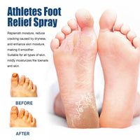 South Moon Athletes Foot Relief Spray, Relieve Foot Sweat Foot Itching Peeling Gray Nails Foot Odor Moisturizing Care Spray