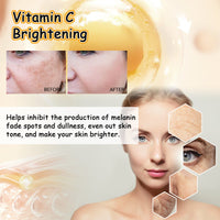 Vitamin C Brightening Cream, Improve Drying To Reduce Fine Lines Held Acne Moist Brightens The Face Cream