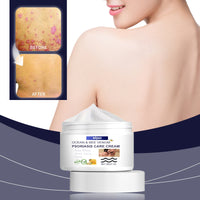 Wiyun Bee-Venom Cowhide Moss Care Cream, Relieve Hands And Feet Skin Itching Discomfort Moisturizing Skin Cooling Care Cream