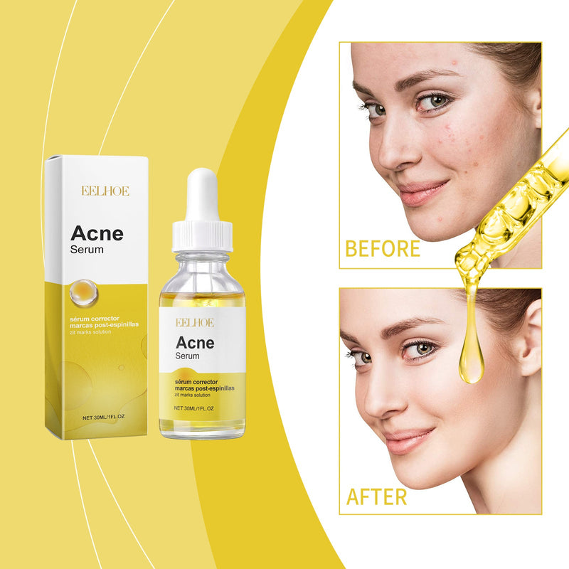 Face Essence Repair Acne Muscle Acne Closing Gentle Cleansing Face Skin Face Essence