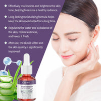 Nicotinamide Anti-Acne Firming Serum Mild Moisturizing And Lightening Facial Acne Tender Skin Serum
