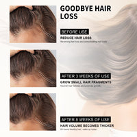 Scalp Oil Serum Massages Your Scalp, Nourishes Your Hair And Moisturizes Your Hair