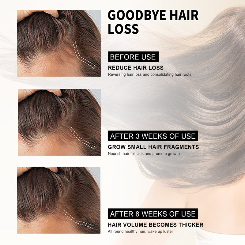 Scalp Oil Serum Massages Your Scalp, Nourishes Your Hair And Moisturizes Your Hair