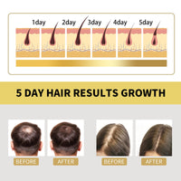 Ginger Dense Hair Shampoo, Moisturizes Reduces Itchiness, Strengthens Dense And Fluffy Hair Care Shampoo