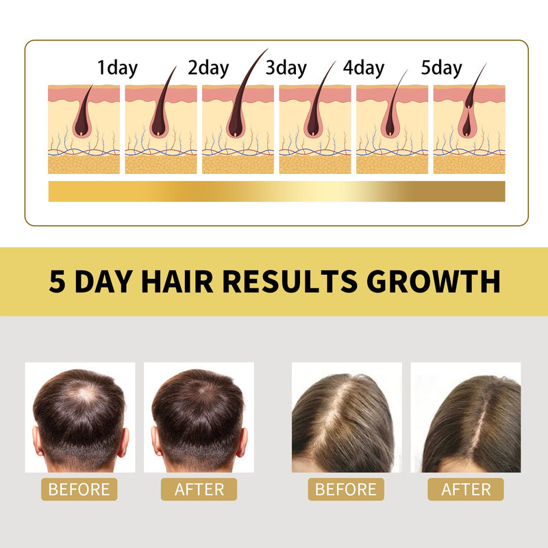 Ginger Dense Hair Shampoo, Moisturizes Reduces Itchiness, Strengthens Dense And Fluffy Hair Care Shampoo