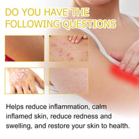 Multi Purpose Psoriasis Cream, Relieve Itchy Skin Red Body Pain Nursing Care Moist Skin Itching
