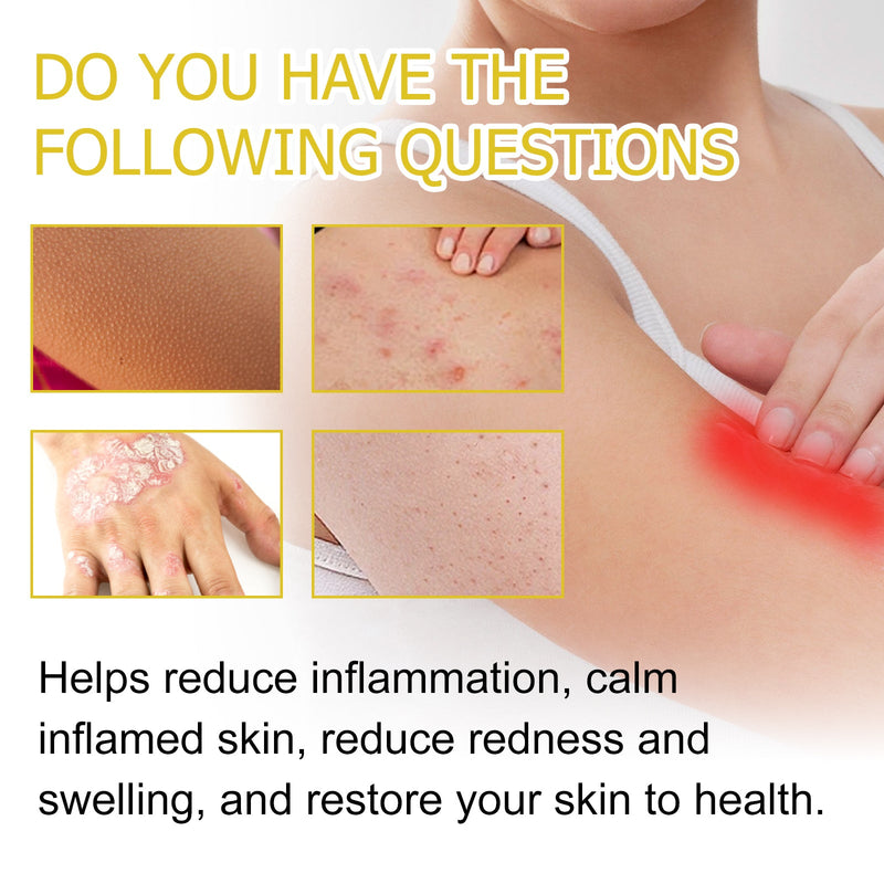Multi Purpose Psoriasis Cream, Relieve Itchy Skin Red Body Pain Nursing Care Moist Skin Itching