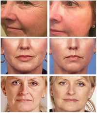 Instant Wrinkle Removal Multi Bounce Balm Facial Tightening Moisturizing Korean Anti-Wrinkle Balm Stick Cream Skin Care Products