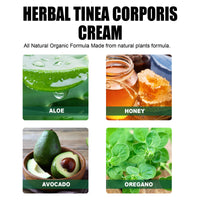 Herbal Tinea Corproris Cream, Mild Non-Irritating Ointment For Itch Relief External Ointment For The Body