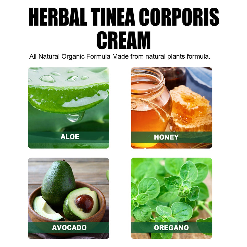 Herbal Tinea Corproris Cream, Mild Non-Irritating Ointment For Itch Relief External Ointment For The Body