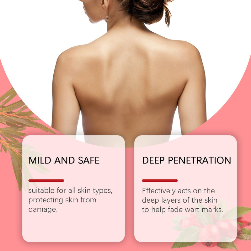 Ouhoe Rosehip Seed Wart Essence Oil Skin Label Repair And Fade Mole Corns Meat Kernel Essence