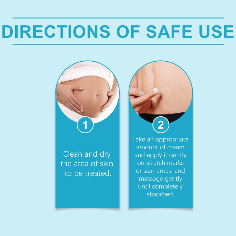 Ouhoe Pregnancy Care Cream, Repair Postpartum Skin Fine Lines Moisturizing Smooth Skin Whitening Pregnancy Care Cream