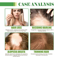 Hair Care Oil, Repair Damage Improve Dry Hair Prevent Hair Loss And Smooth Essential Oil