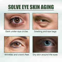 Care Eye Cream Reduces Fine Lines, Improves Dullness, Moisturizes, Moisturizes, Firmers And Strengthens Multi-Effect Skin