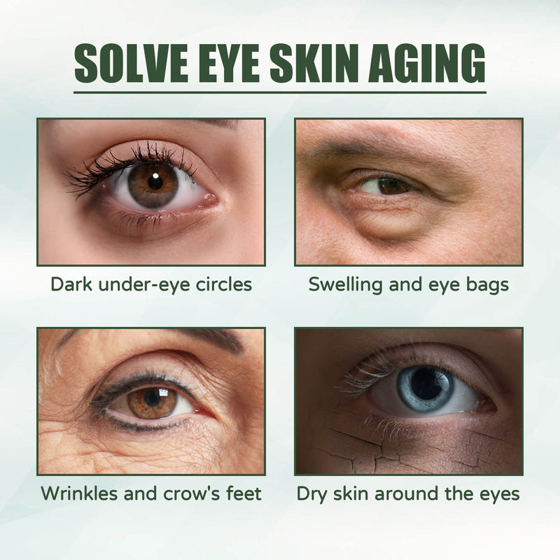 Care Eye Cream Reduces Fine Lines, Improves Dullness, Moisturizes, Moisturizes, Firmers And Strengthens Multi-Effect Skin