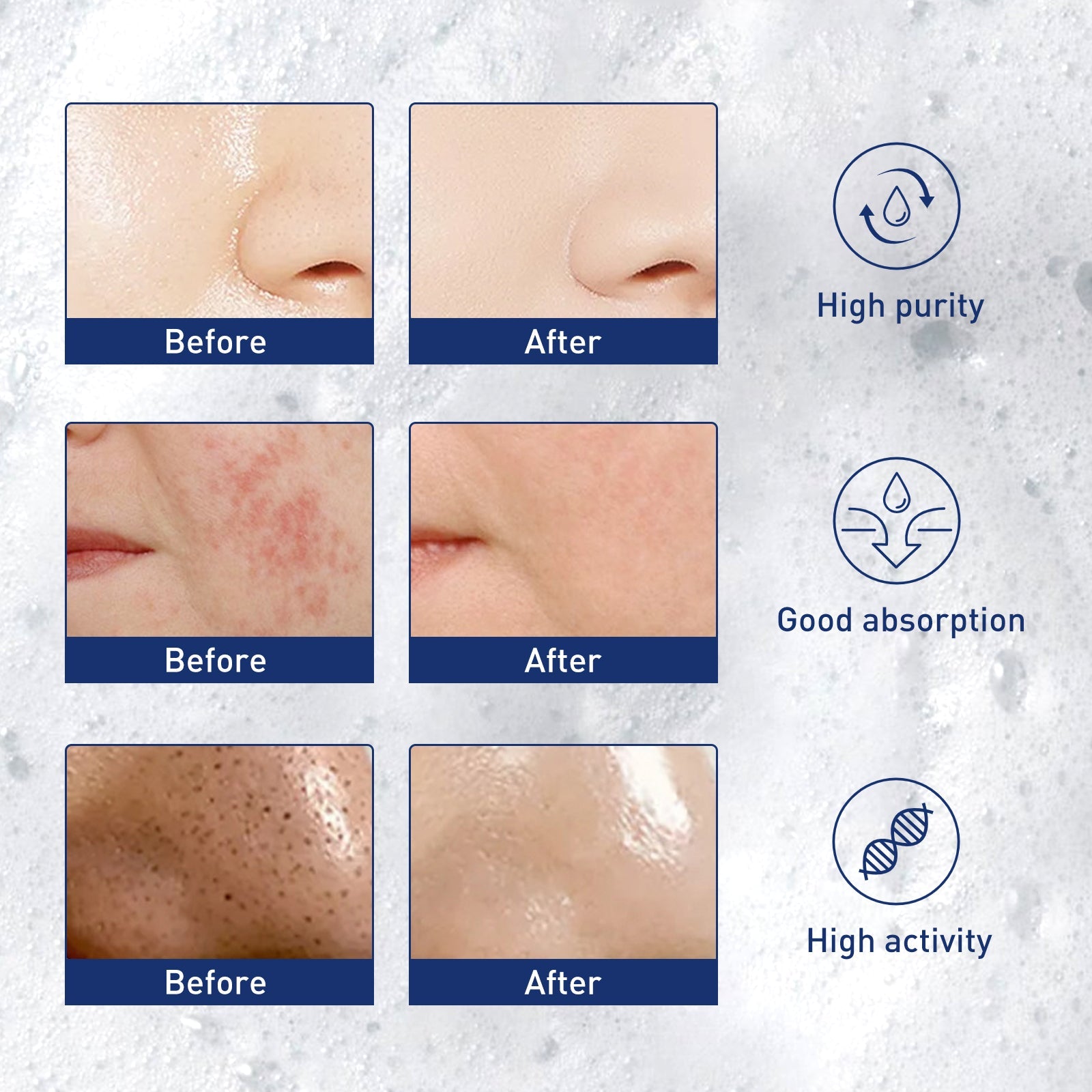 Exfoliating Mousse, Cleanser Skin Pore Control Oil Gently Cleanses Exfoliating Dead Blackheads