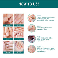Toenail Repair Solution Smoothing Nail And Hand, Foot And Nail Cleansing And Nourishing Repair Solution