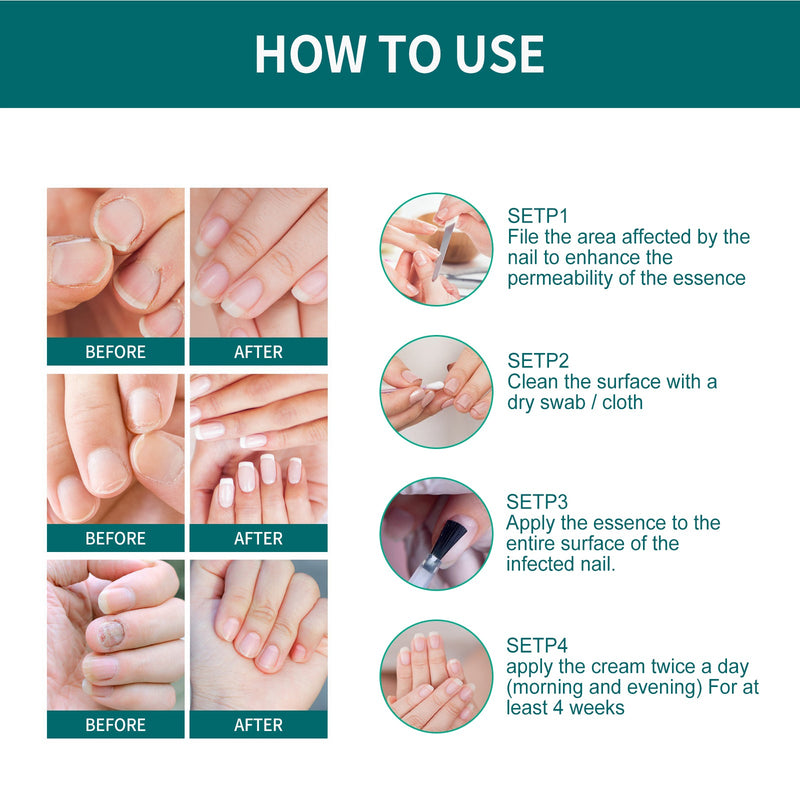 Toenail Repair Solution Smoothing Nail And Hand, Foot And Nail Cleansing And Nourishing Repair Solution