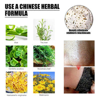 Blackhead Removal Mask, Peel Off Remove Blackhead Activated Carbon Cleansing Face Mask