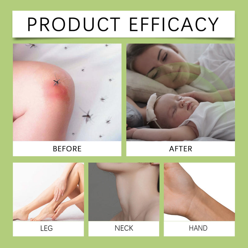 Ximonth Mosquito Repellent Spray for Home, Camping, Outdoor Activities - Portable Insect Bite Prevention and Mosquito Repellent Liquid