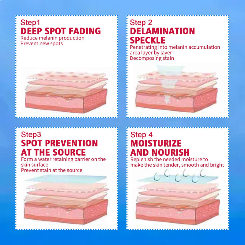Blemish Cream, Whitening Skin Reduce Melanin Melasma Stains And Hydrating Cream