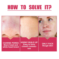 Pore Shrink Cream, Lightening Acne Print Anti-Aging Moisturizing Whitening Skin Anti-Wrinkle Cream