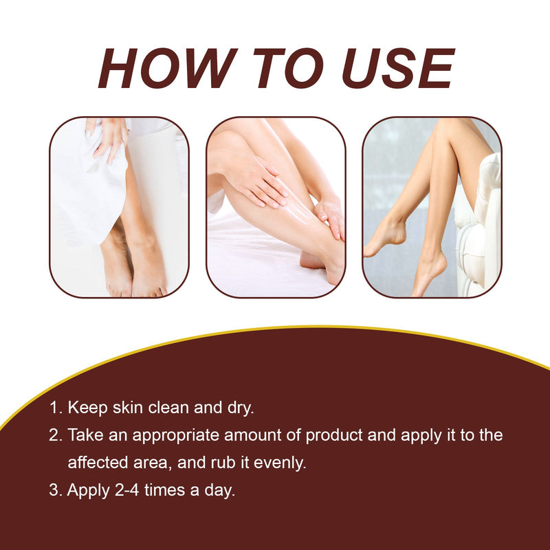 Leg Treatment Cream, Leg Massage Treatment For Leg Discomfort Earthworm Leg Body Treatment Cream
