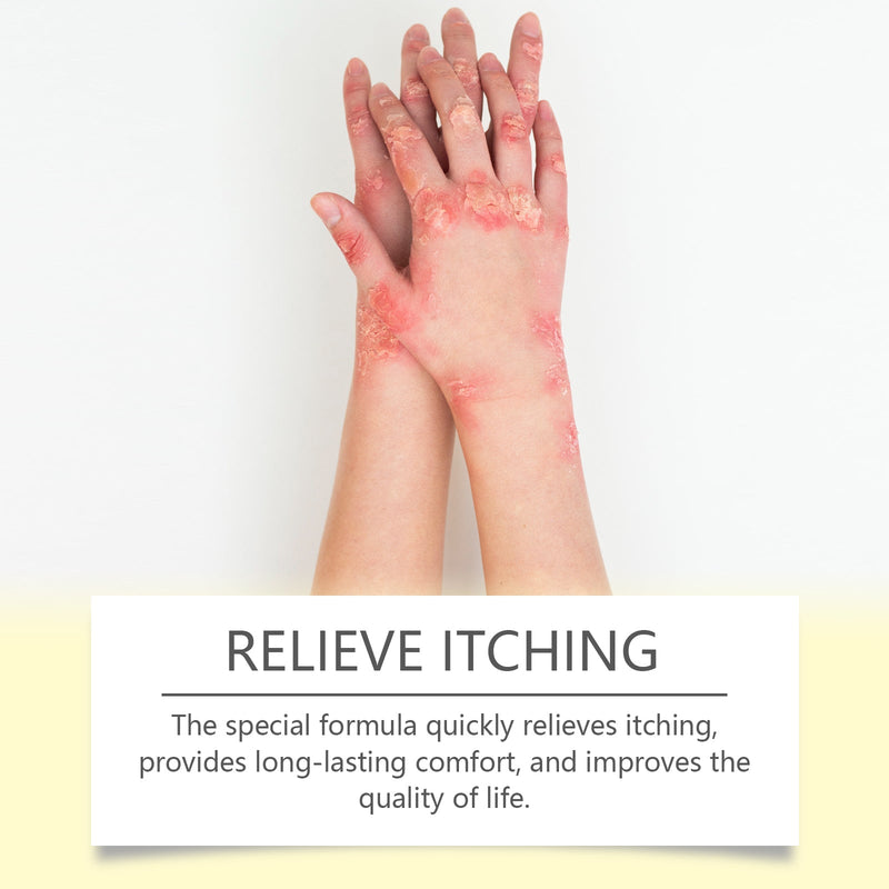 Skin Repair Cream, Skin Repair Cream For The Body And Hands And Feet