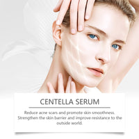 Hoygi Centella Essence Tightens And Moisturizes Skin, Moisturizes, Hydrates And Brightens Daily Facial Skin Care Essence